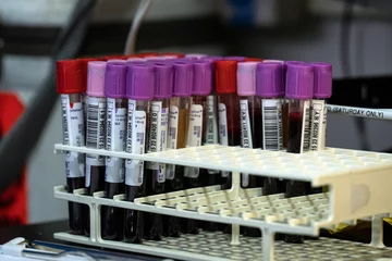 Hematology imagery - blood platelet samples 