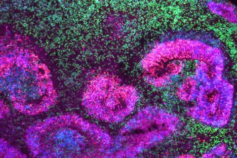 Alzheimer's research microscopy